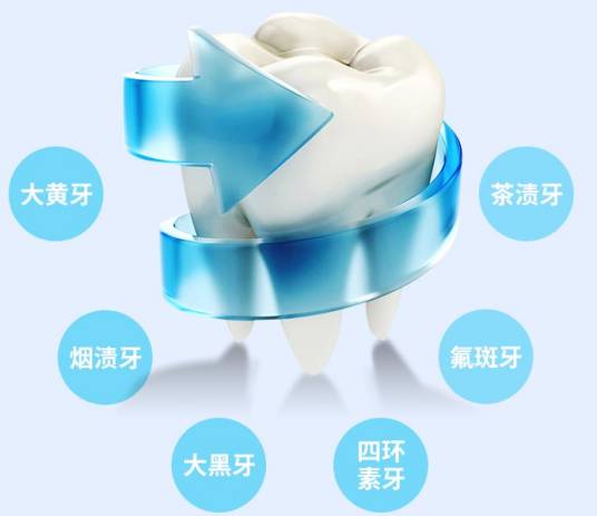 特美牙齿冷光美白