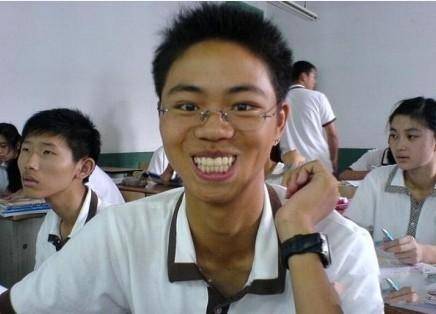 龅牙(常见的一类牙颌面畸形)