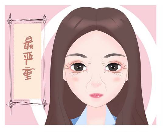 鱼尾纹(衰老表现)