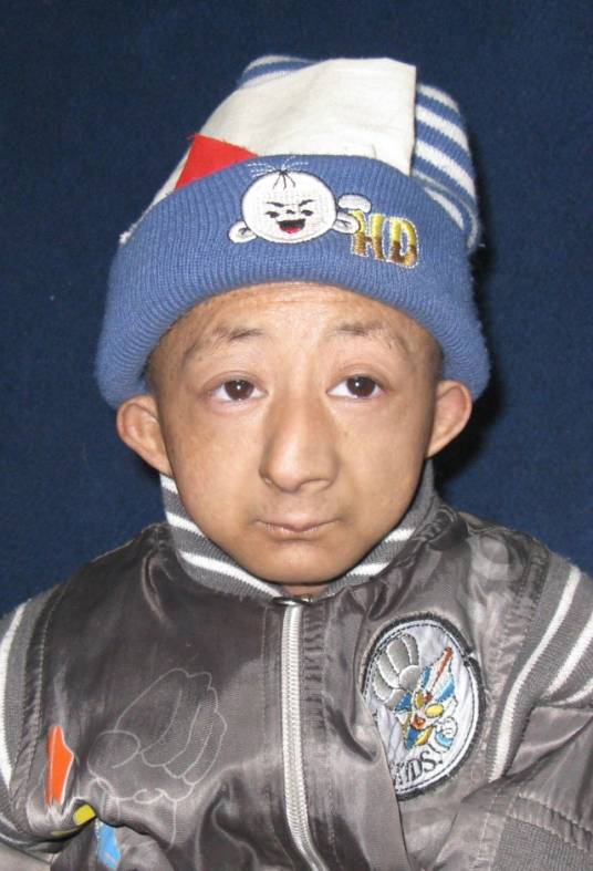 何平平（袖珍矮人）