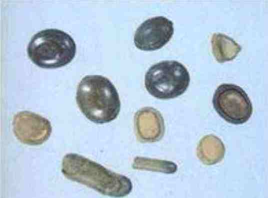 猴枣(消痰镇惊清热解毒类中药)