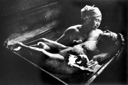 日本水俣病事件