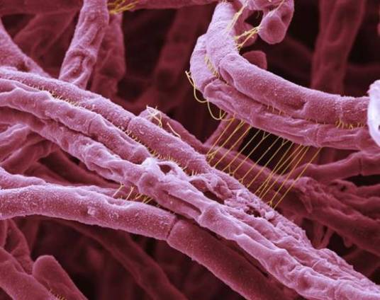 超级病毒(超级病毒是能致人于死地无药可救的病菌)