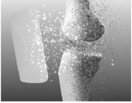 骨病（骨科疾病三大病学之一）