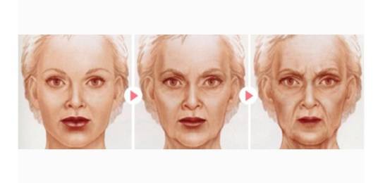 肌肤衰老