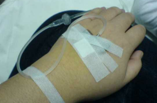 输液（医学名词）