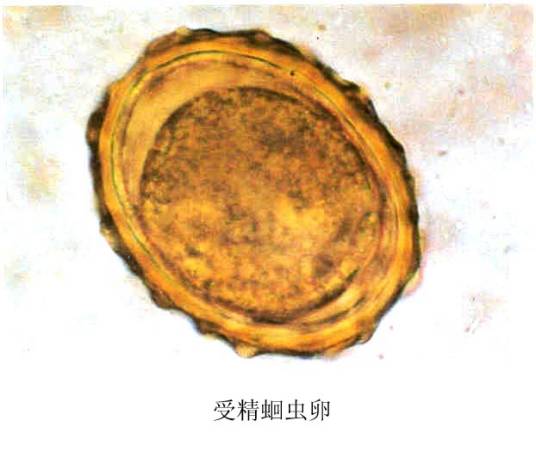 蛔虫卵