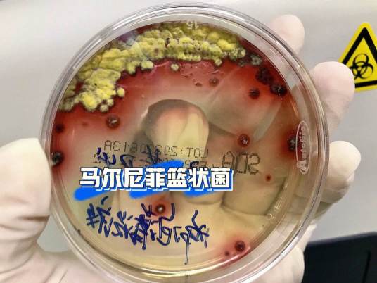 马尔尼菲篮状菌