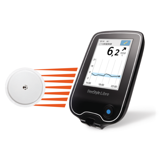 雅培瞬感血糖仪