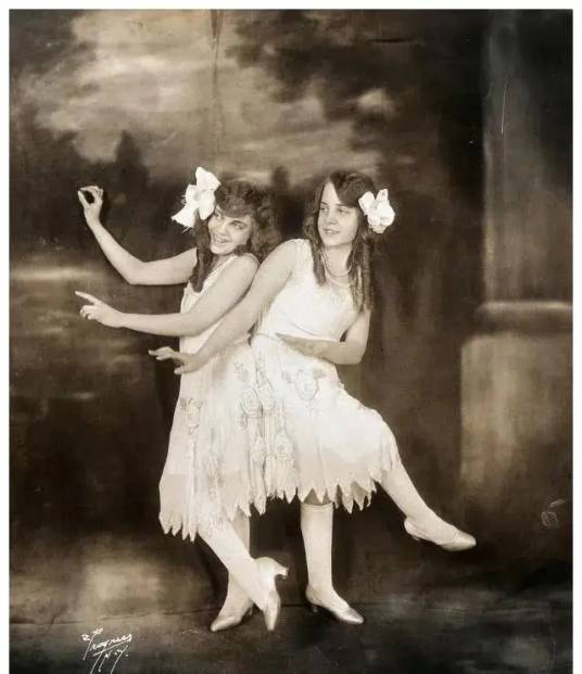 连体人（罕见的妊娠现象）