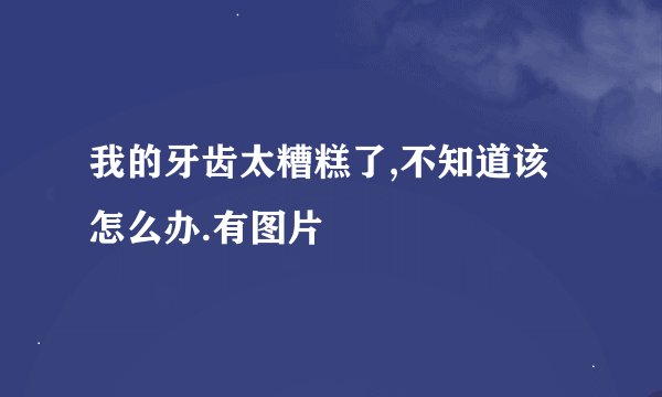 我的牙齿太糟糕了,不知道该怎么办.有图片