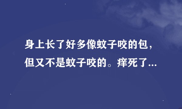 身上长了好多像蚊子咬的包，但又不是蚊子咬的。痒死了。怎么办？