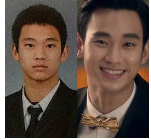 金秀贤自认整容是真的吗？