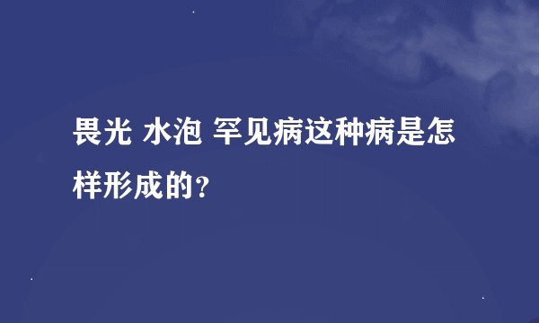 畏光 水泡 罕见病这种病是怎样形成的？