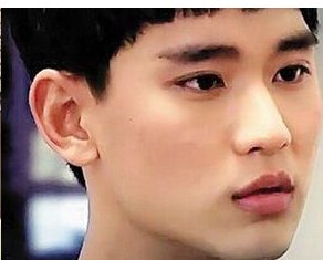 金秀贤自认整容是真的吗？